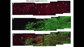 quotFunctional Regeneration Into and Well Beyond the Glial Scarquot  Dr Jerry Silver [upl. by Eiger]