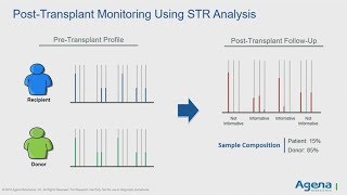 Chimerism Made Easy How Agena’s Chimeric ID Panel Simplifies Traditional STRBased Testing [upl. by Kaye375]