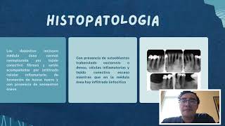 Osteitis Condensante [upl. by Haisej]