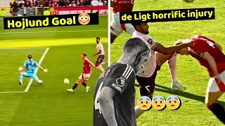 🚨Matthijs de Ligts horrific injury moment in Manchester United Vs Brentford 21 [upl. by Morgen]