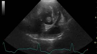 Echocardiography canine infective endocarditis [upl. by Harbison]