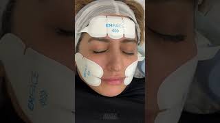 Less Wrinkles amp More Lift with No Needle EMFACE  DR MEDISPA [upl. by Fernas389]