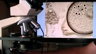 Demonstration microscope olympus CH2 a contraste de phase pour dentiste [upl. by Idahs426]