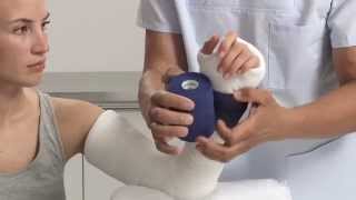 Plaster of Paris Elbow Splint Application [upl. by Naesyar]