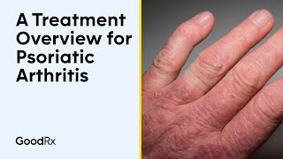 A Treatment Overview for Psoriatic Arthritis  GoodRx [upl. by Armanda874]