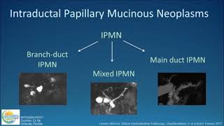 Approach to Cystic Lesions of the Pancreas [upl. by Acisse141]