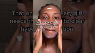 How to fade hyperpigmentation FAST [upl. by Kester]