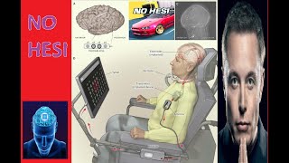 Neuralinks patient plays Assetto Corsa using his brain chip [upl. by Iredale]