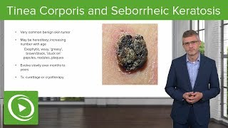 Tinea Corporis Ring Worm and Seborrheic Keratosis – Dermatology  Lecturio [upl. by Chic]