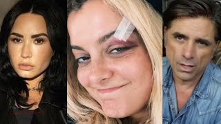 Celebs React To Bebe Rexhas Phone Throwing Injury [upl. by Missie344]