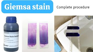 Giemsa Stain Procedure for Blood SmearHow to do Giemsa StainGiemsa Staining ProcedureAdnanMLT [upl. by Ipoillak]