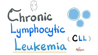 Chronic Lymphocytic Leukemia CLL  Etiology Risk Factors Symptoms Signs Diagnosis Treatment [upl. by Ylecic]