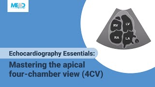 Echocardiography Essentials Mastering the apical fourchamber view 4CV [upl. by Aylsworth]