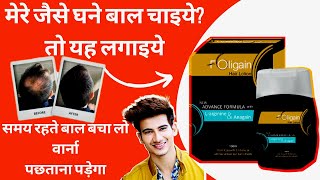 foligain hair lotion review  Honest Review  better than minoxidil  Does It Really Works [upl. by Fuchs]