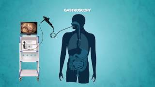 Gastrocopy [upl. by Isla]