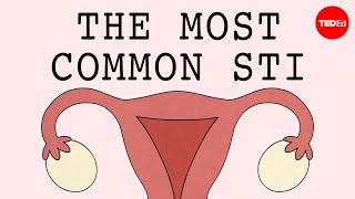 The most common STI in the world  Emma Bryce [upl. by Agnizn]