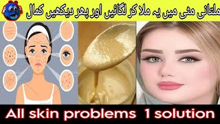 Winters Best Home Remedies  Multani Mitti Face Mask Winter Skin Problems Ka Solution [upl. by Shirleen]