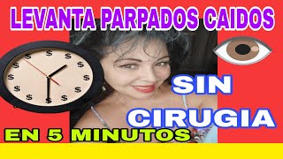 COMO LEVANTAR LOS PARPADOS CAIDOS EN 5 MINUTOS SIN CIRUGIA [upl. by Nodlehs814]