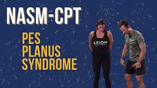 Pes Planus Syndrome  NASMCPT Assessments [upl. by Yanad]