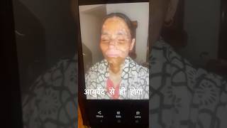 Vitiligo Recovery Incredible Transformation with Ayurveda [upl. by Tolkan]