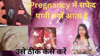 white discharge in pregnancyक्या pregnancy में white discharge नार्मल है।pregnancydrromagupta [upl. by Anilam]