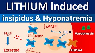 Lithium induced diabetes insipidus and hyponatremia [upl. by Aihsat]