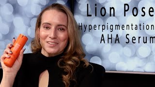 Lion Pose 🆕 UNSPOTTED 4X Dark Spot  Hyperpigmentation AHA Serum Review How to Use Dupes [upl. by Herrick]