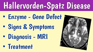 HallervordenSpatz Disease PKAN Cause Symptoms Radiology Treatment  Developmental Regression [upl. by Yecam]