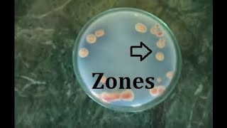 How to isolate phosphate solubilizing bacteria [upl. by Ahsinawt]