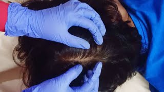 ASMR  Scalp Check amp Massage With Gloves  310 [upl. by Annawak]