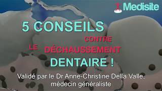 5 conseils contre le déchaussement dentaire [upl. by Nwahsad]