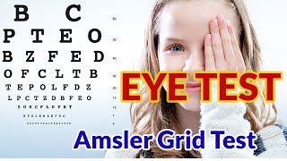 eye testdo your eyesigt testamsler grid test [upl. by Ived]