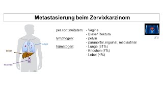 Metastasierung beim Zervixkarzinom  Strahlentherapie Prof Hilke Vorwerk [upl. by Thema]