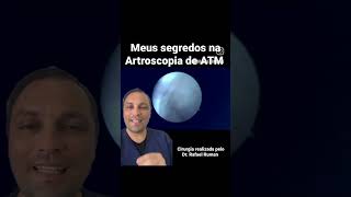 Compartilhando meus segredos na Artroscopia de ATM com você [upl. by Louisa]