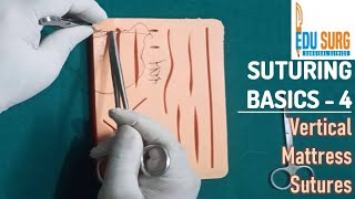 Vertical mattress suture l OSCE skill station l Suturing techniques part 3 [upl. by Tsew784]