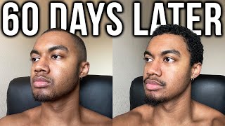 I Tried a Hair Growth Kit for 60 Days Heres What Happened ft Copenhagen Grooming [upl. by Weir]