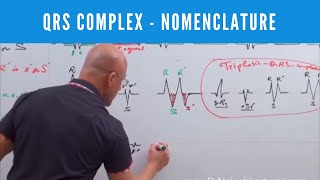 ECG  QRS Complex in EKG  Nomenclature  Electrocardiography🫀 [upl. by Lillith2]