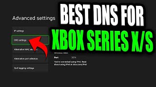 Best DNS Server For Xbox Series XS Faster internet for FREE by changing this one setting [upl. by Earehc345]