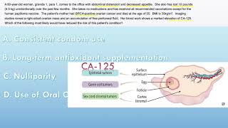 USMLE Questions Ovarian Tumors [upl. by Alah792]