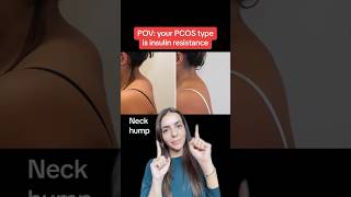 POV you have Insulin Resistant pcos [upl. by Siesser]