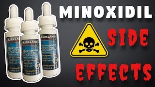 Minoxidil Side Effects  What To Expect [upl. by Shreeves]