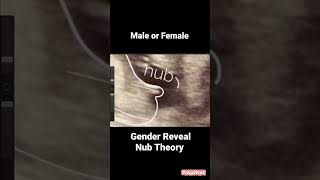 Guess the gender with nub theorybaby boy pregnancycare pregnancy ultrasound [upl. by Rorie177]