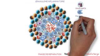 PHASE DE RÉPARATION  FORMES ANATOMOCLINIQUES DE L’INFLAMMATION [upl. by Auqeenwahs672]