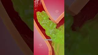 How acid reflux happens 🥵 Acidity and gas problem  GERD shorts viralvideo  creativelearning3d [upl. by Asnarepse]