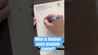 Understanding Gleason score Prostate cancer [upl. by Cianca]