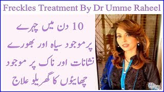 Atni Freckles Treatment at Home  Dr Umee Raheel Tips  100 effective results [upl. by Wachter]