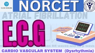 ABNORMAL HEART RHYTHM ECG  CARDIO VASCULAR SYSTEM DYSRHYTHMIA  MEDICAL SURGICAL NURSING  norcet [upl. by Ahsekad]