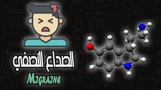 الصداع النصفي  Migraine [upl. by Anhcar]