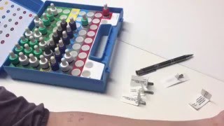 Allergietest  Prick Test [upl. by Adnaloj]