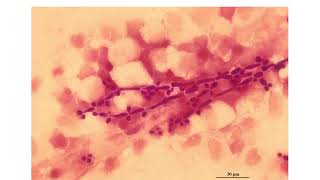 MEDICAL MYCOLOGY  LECTURES 3 [upl. by Myrt]